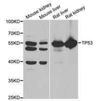 Anti-TP53抗体_上海康朗生物科技有限公司_抗