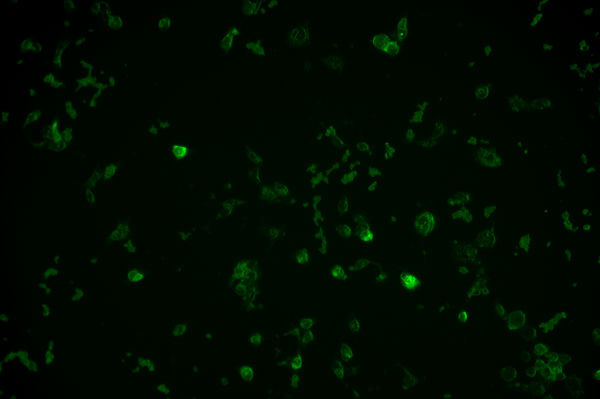 荧光生物显微镜MF43-M应用于FISH技术与癌症诊断