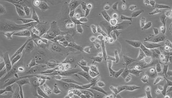 HPDE6-C7人正常胰腺导管上皮细胞的知识与应用！