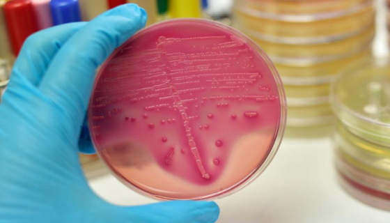 细菌学检查的分离培养与接种实验方法有哪些？
