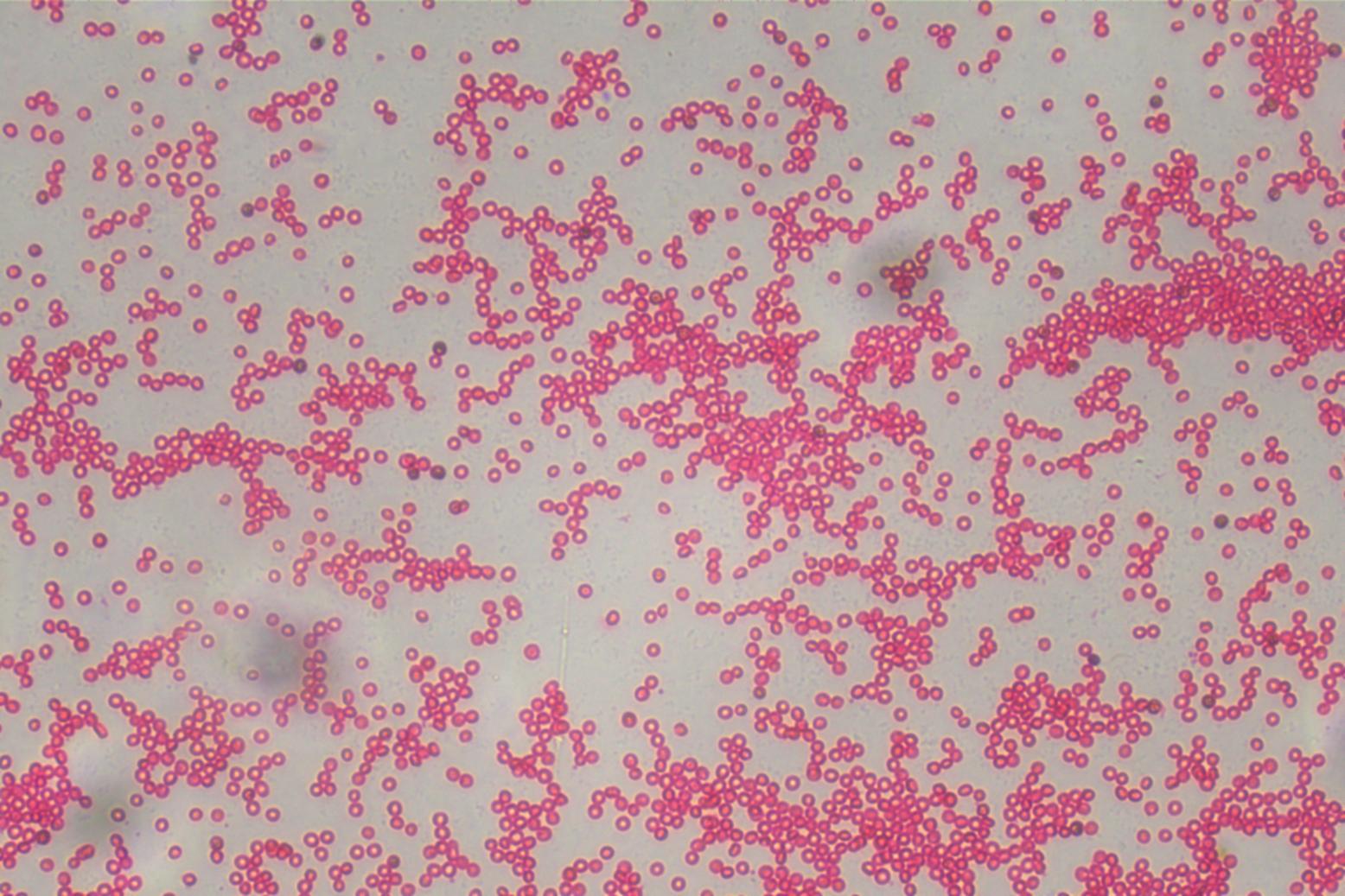 倒置显微镜下的红细胞
