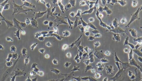 RMC-1大鼠视网膜MULLER细胞的培养操作规程！