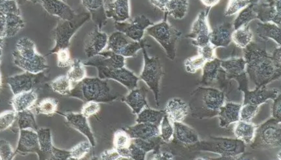 Glioma261（小鼠神经胶质瘤细胞）培养操作规程！