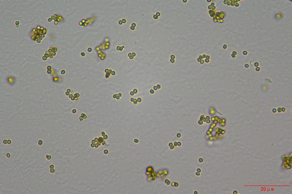 生物显微镜ML31助力酵母菌观察