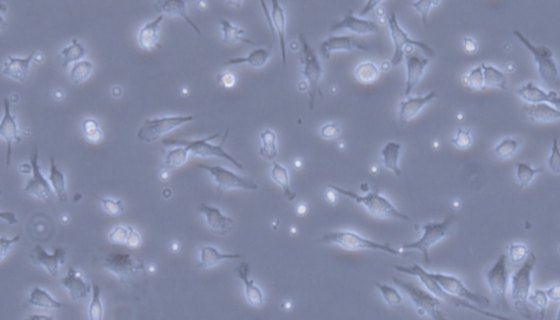 SV40 MES 13小鼠肾小球系膜细胞的培养与处理！