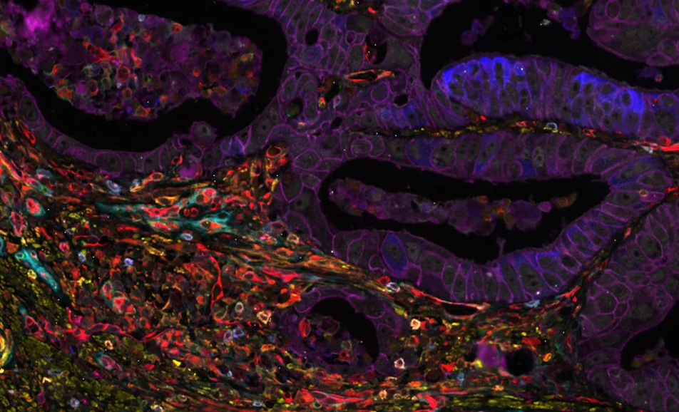 【网络研讨会】利用Cell DIVE 在单细胞水平上进行超复杂癌症组织分析