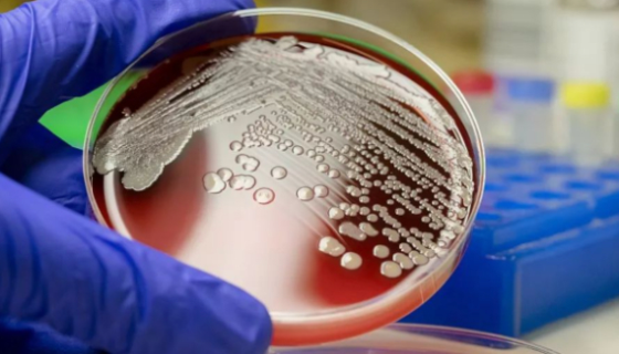 抗生素对微生物生长的最低抑制浓度的测定方法！
