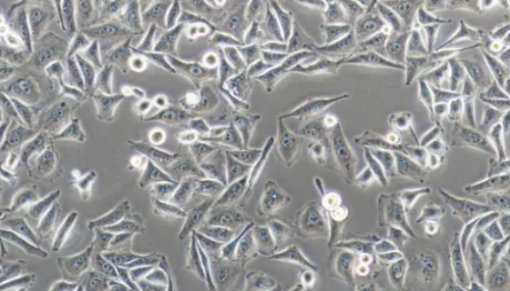 Cattlechondrocytes牛软骨细胞的实验操作规程！