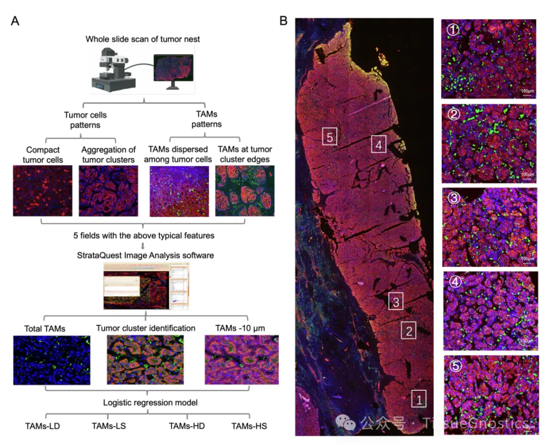 Tissue Cytometry技术助力天津医科大学于津浦/李祥春团队探索HCC内部巨