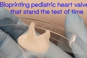 【客户焦点】重塑生命的奇迹：儿科心脏瓣膜生物打印经得起时间的考验！