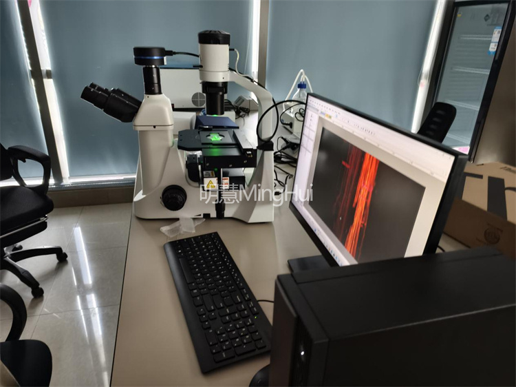 明慧倒置荧光显微镜MHIF2000+MHS900应用于活细胞多色荧光成像