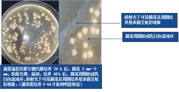 守护夏日食品安全|椰酵假单胞菌最新鉴定方案