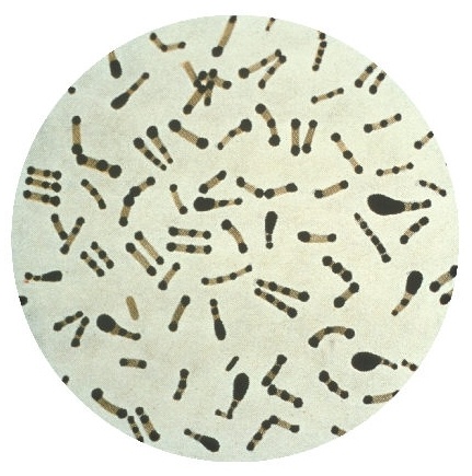 光学显微镜用于白喉杆菌观察