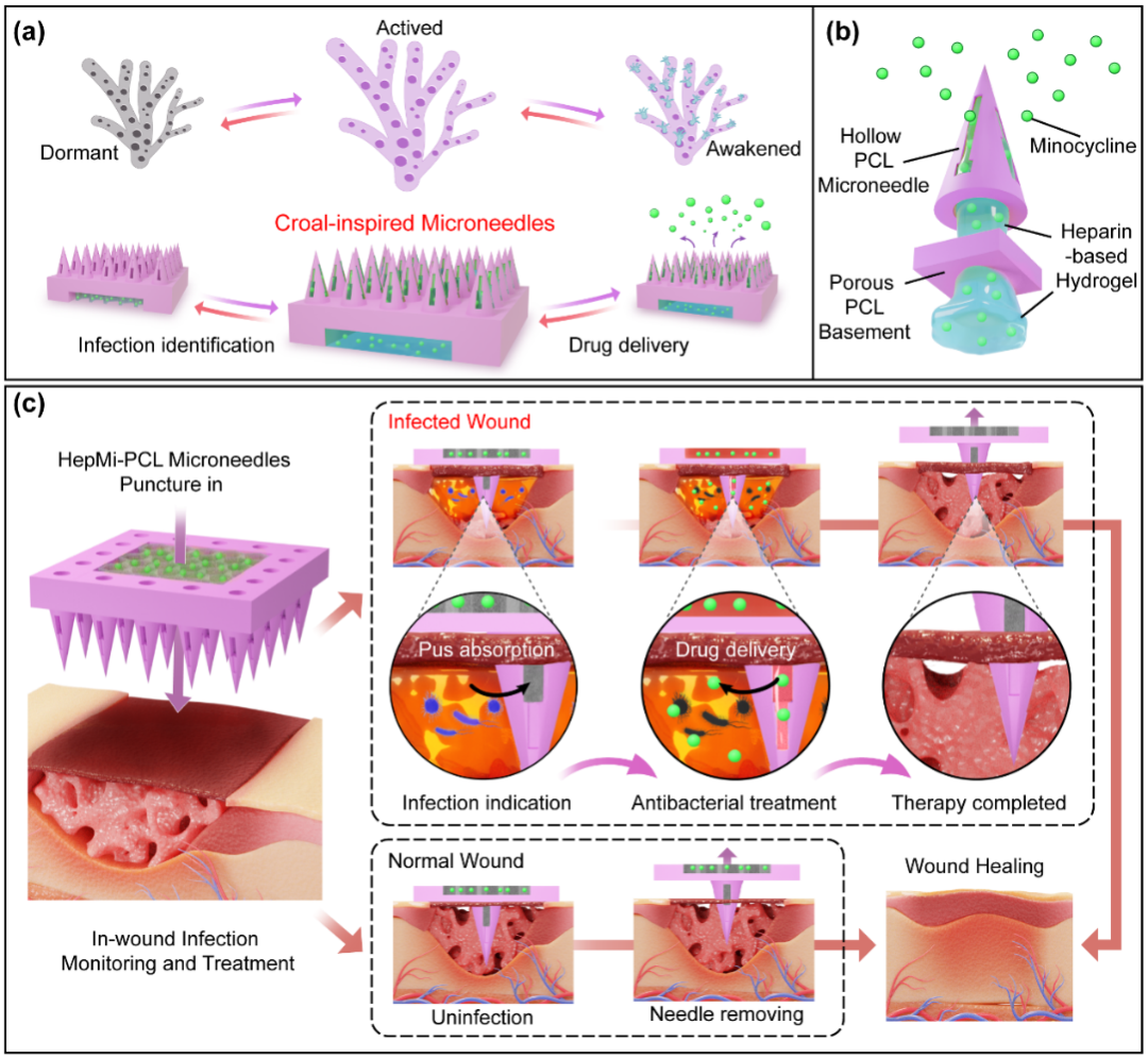 浙江大学、四川大学华西口腔医院等团队《AFM》：仿生珊瑚的3D打印中空微针实现感染性创伤的智能响应治