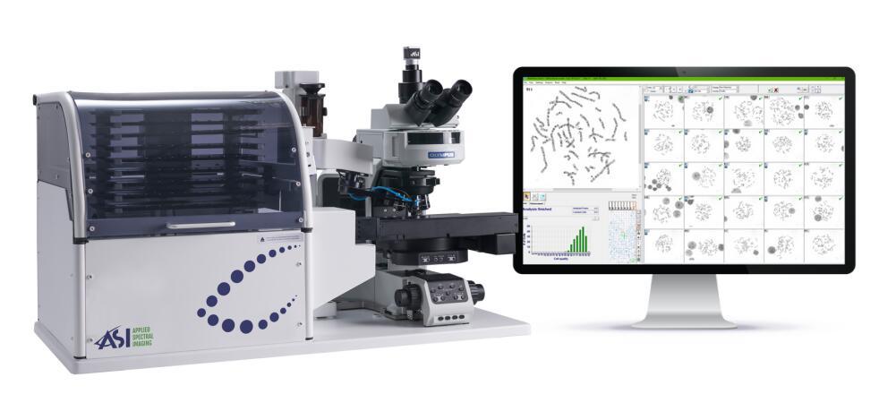 ASI新一代HiBand人工智能辅助AI在染色体核型分析的应用