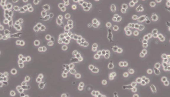 HDLM-2人霍奇金淋巴瘤细胞的性质与用途及生产工艺！