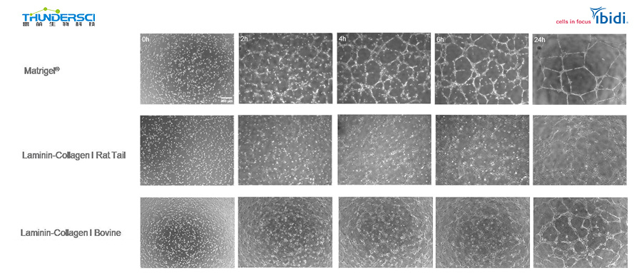 血管生成protocol|利用层粘连蛋白-胶原蛋白进行成管实验