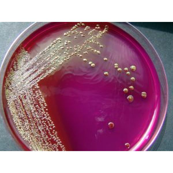 葡萄球菌选择性琼脂   