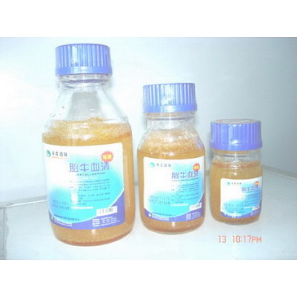 人血清IgM（液体）70-80%纯度