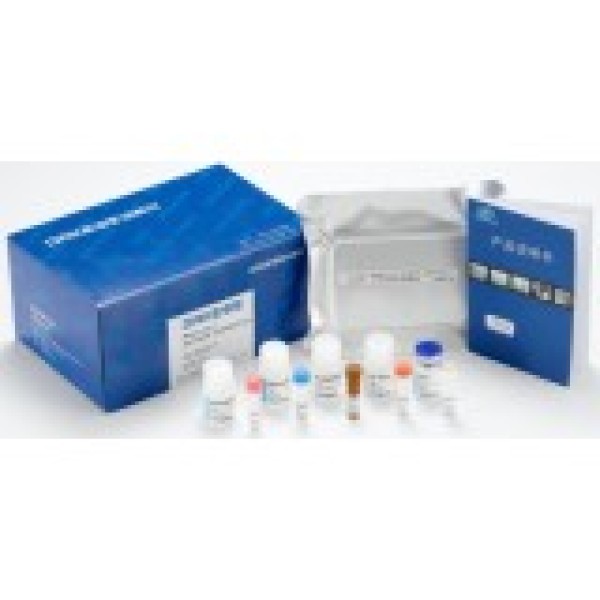 鸡脂肪酸合酶(FASN)检测试剂盒