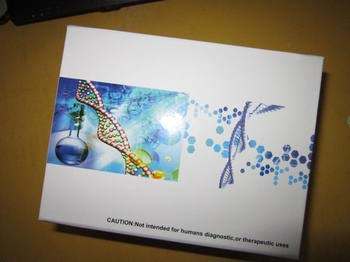 小鼠抗心磷脂抗体IgG(ACA-IgG)免疫组化试剂盒