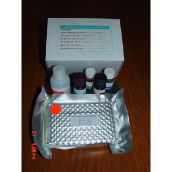 人A组链球菌菌壁多糖抗体(ASP)ELISA Kit
