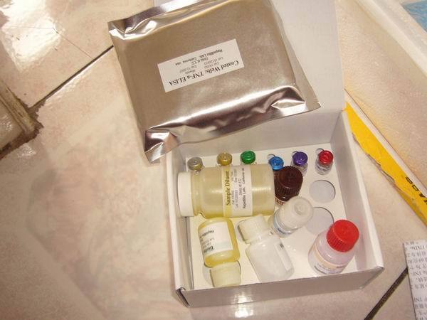人游离前列腺特异性抗原(fPSA)ELISA试剂盒 