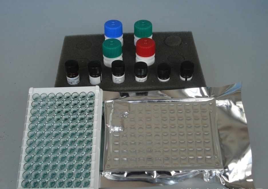 人抗链球菌溶血素O/抗O(ASO)ELISA试剂盒 