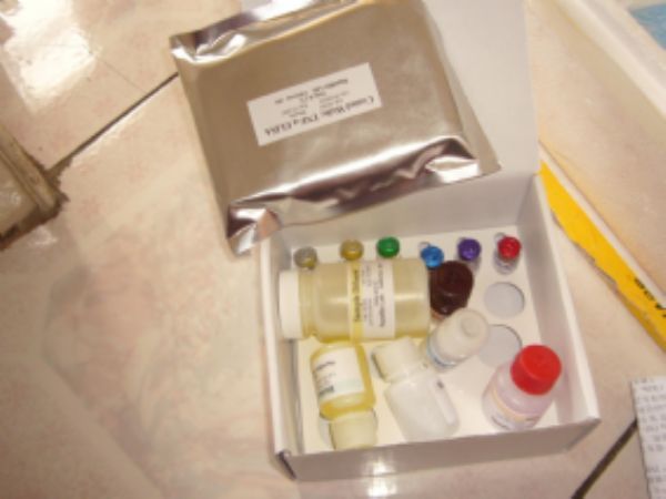 人腺苷脱氨酶(ADA)ELISA试剂盒