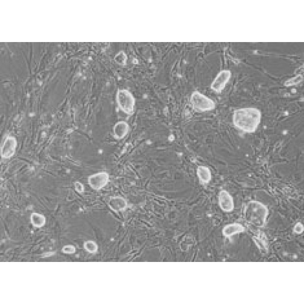稳定表达EBNA1的人胚肾细胞 293E细胞