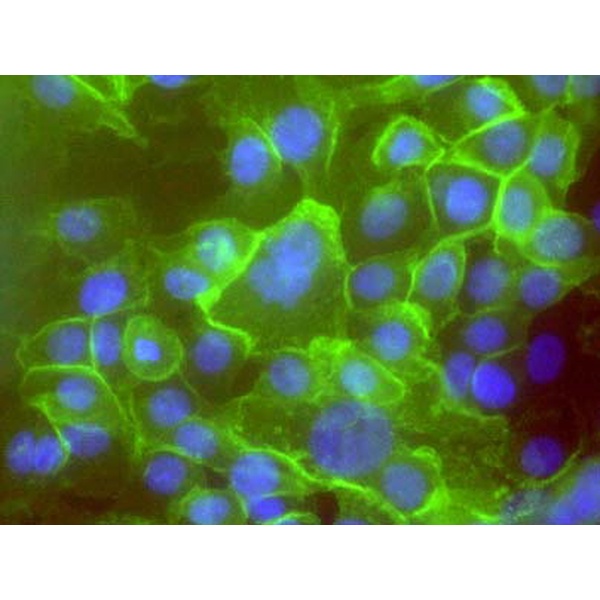 转染了microRNA-mock基因的阴性对照细胞 Hela-mock细胞 