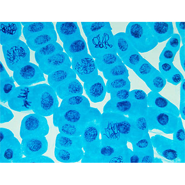 人髓母细胞瘤细胞 D341Med细胞