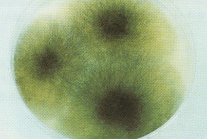 黑化链霉菌