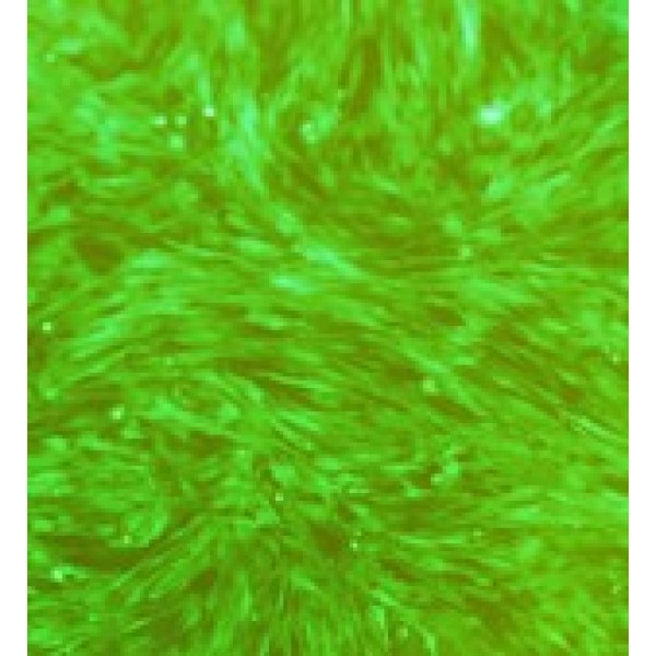 人视网膜神经胶质瘤细胞 WERI-Rb-1细胞