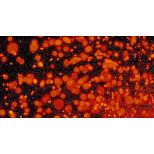 人急性淋巴母细胞白血病细胞 MOLT-4细胞
