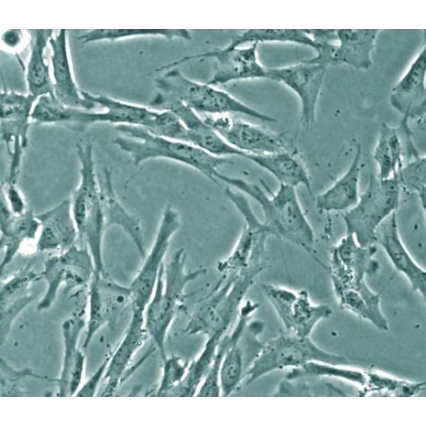 胎儿骨髓间充质细胞 FBM细胞