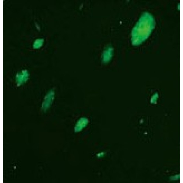 人肺癌亚历山大细胞系 PLC/PRF/5细胞