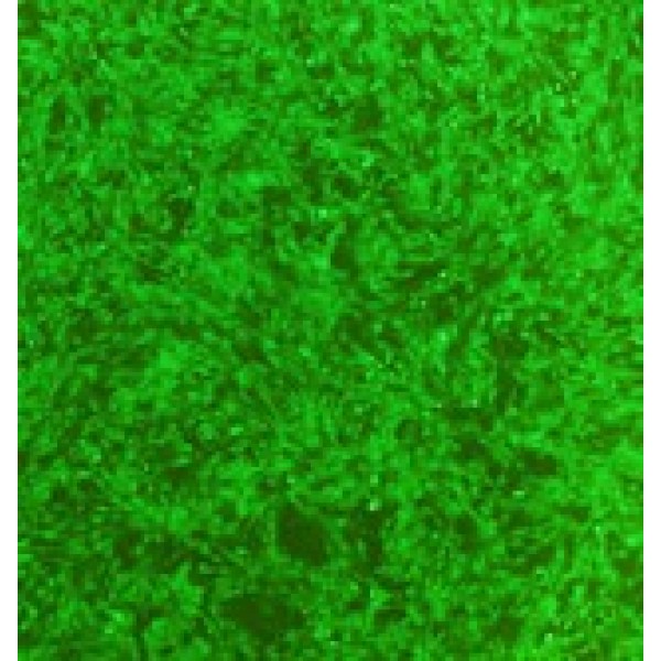 人视网膜母细胞瘤 Y79细胞