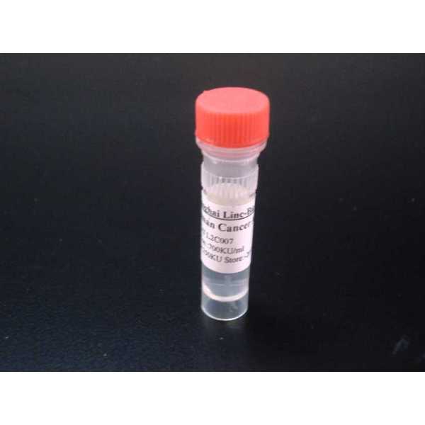 甲胎蛋白单克隆抗体(检测)
