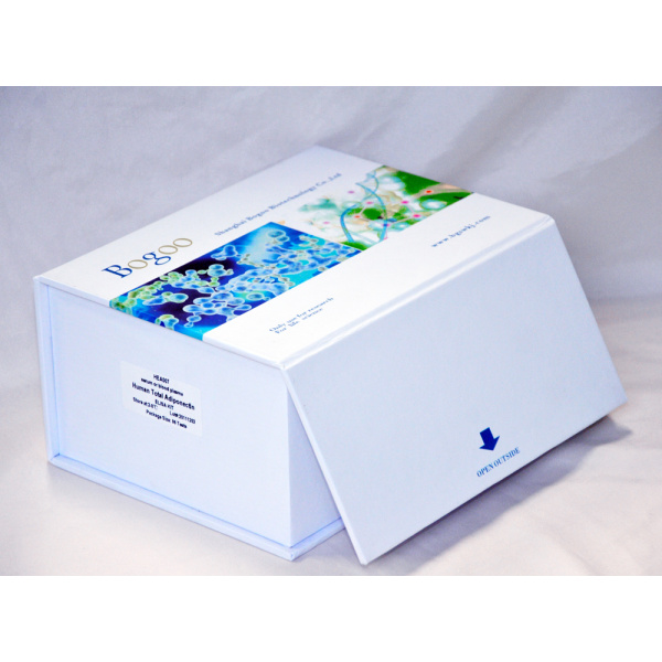 人抗腮腺管抗体(anti-parotid duct Ab)检测试剂盒