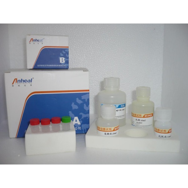 人抗蛋白酶3抗体IgG(PR3 Ab-IgG)检测试剂盒