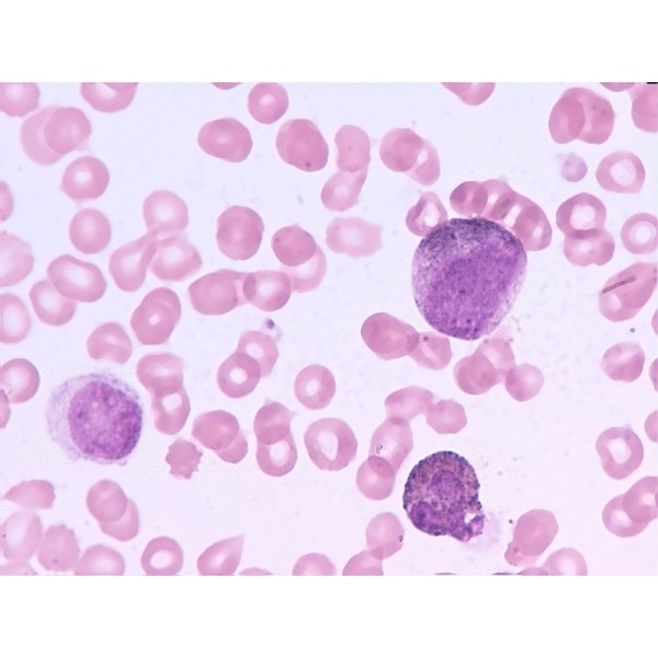 人原巨核细胞型白血病细胞,UT-7细胞