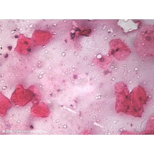 小鼠艾氏腹水瘤细胞