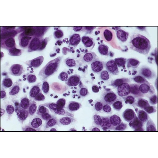 人肺腺鳞癌细胞,NCI-H596细胞