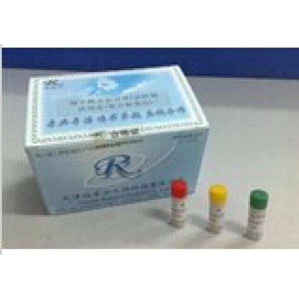 人钙网蛋白(CRT)检测试剂盒 