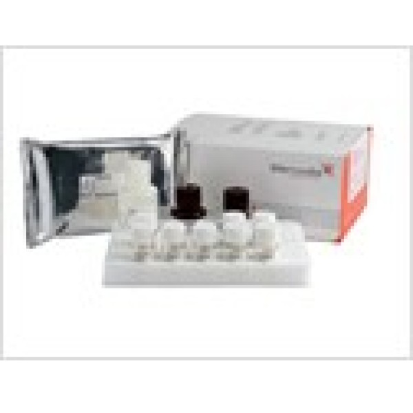 人主要组织相容性复合体Ⅲ类(MHCⅢ/HLA-Ⅲ)ELISA试剂盒 