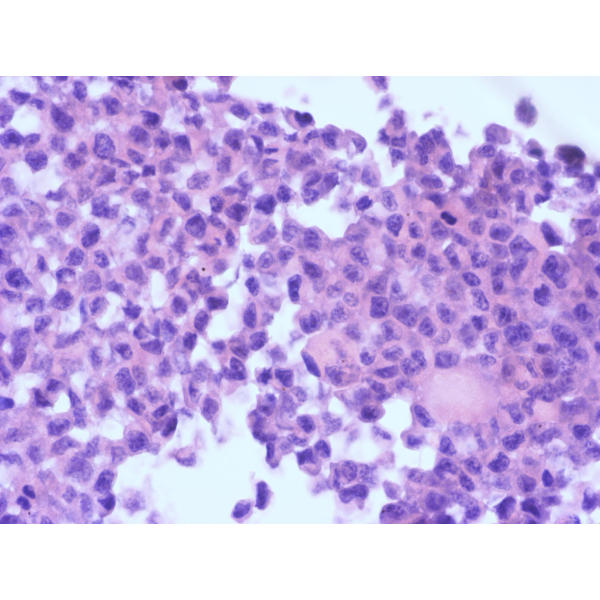 615小鼠网织细胞性白血病瘤株, L615细胞