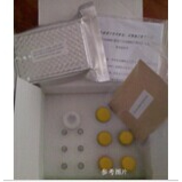 人抗腮腺管抗体(anti-parotid duct Ab)ELISA试剂盒 