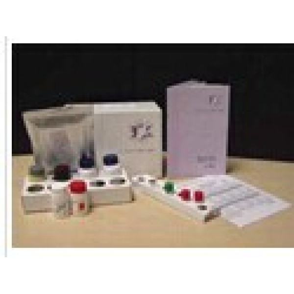 人氧化低密度脂蛋白(OxLDL)ELISA试剂盒 