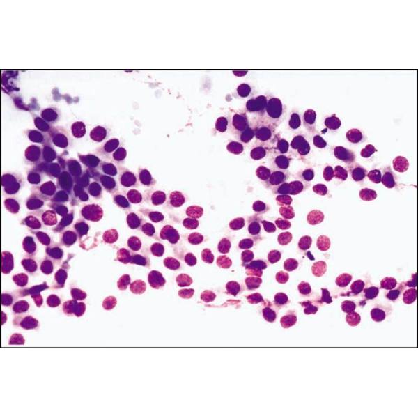 人肺腺癌细胞（胸膜渗出液）Calu-3细胞